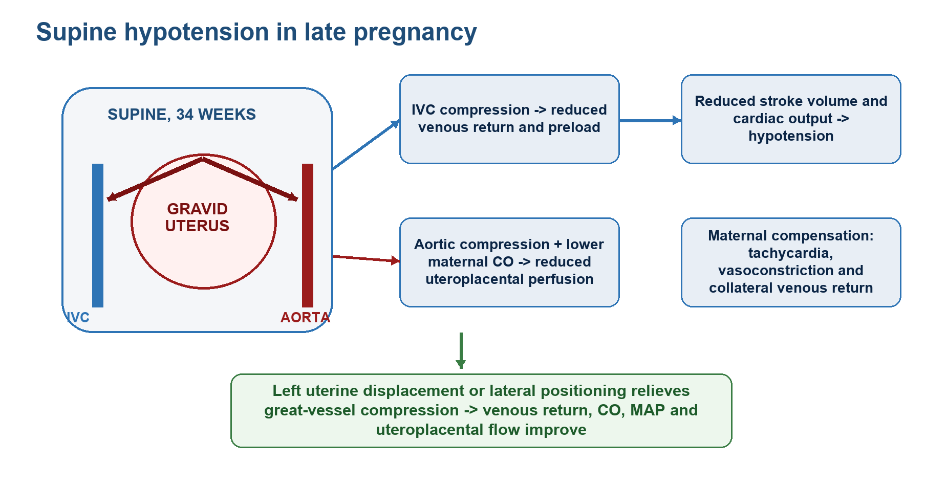 Diagram showing aortocaval compression and supine hypotension in late pregnancy