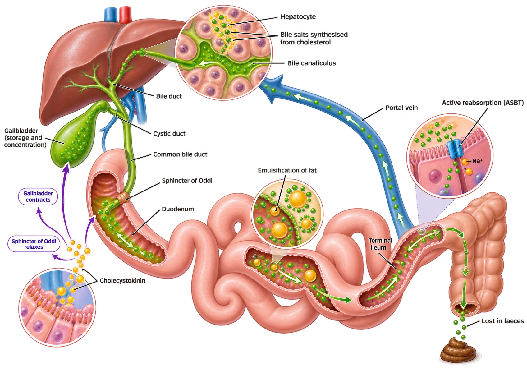 Bile formation and its recycling. In an inset, hepatocytes synthesise bile salts from cholesterol and secrete them into a bile canaliculus. Bile passes through the bile ducts, is stored and concentrated in the gallbladder via the cystic duct, and reaches the duodenum through the common bile duct and the sphincter of Oddi. Cholecystokinin from the duodenal mucosa contracts the gallbladder and relaxes the sphincter. In the small intestine bile salts emulsify fat; at the terminal ileum they are actively reabsorbed by the sodium-coupled ASBT transporter and return to the liver in the portal vein, with a small fraction lost in faeces.
