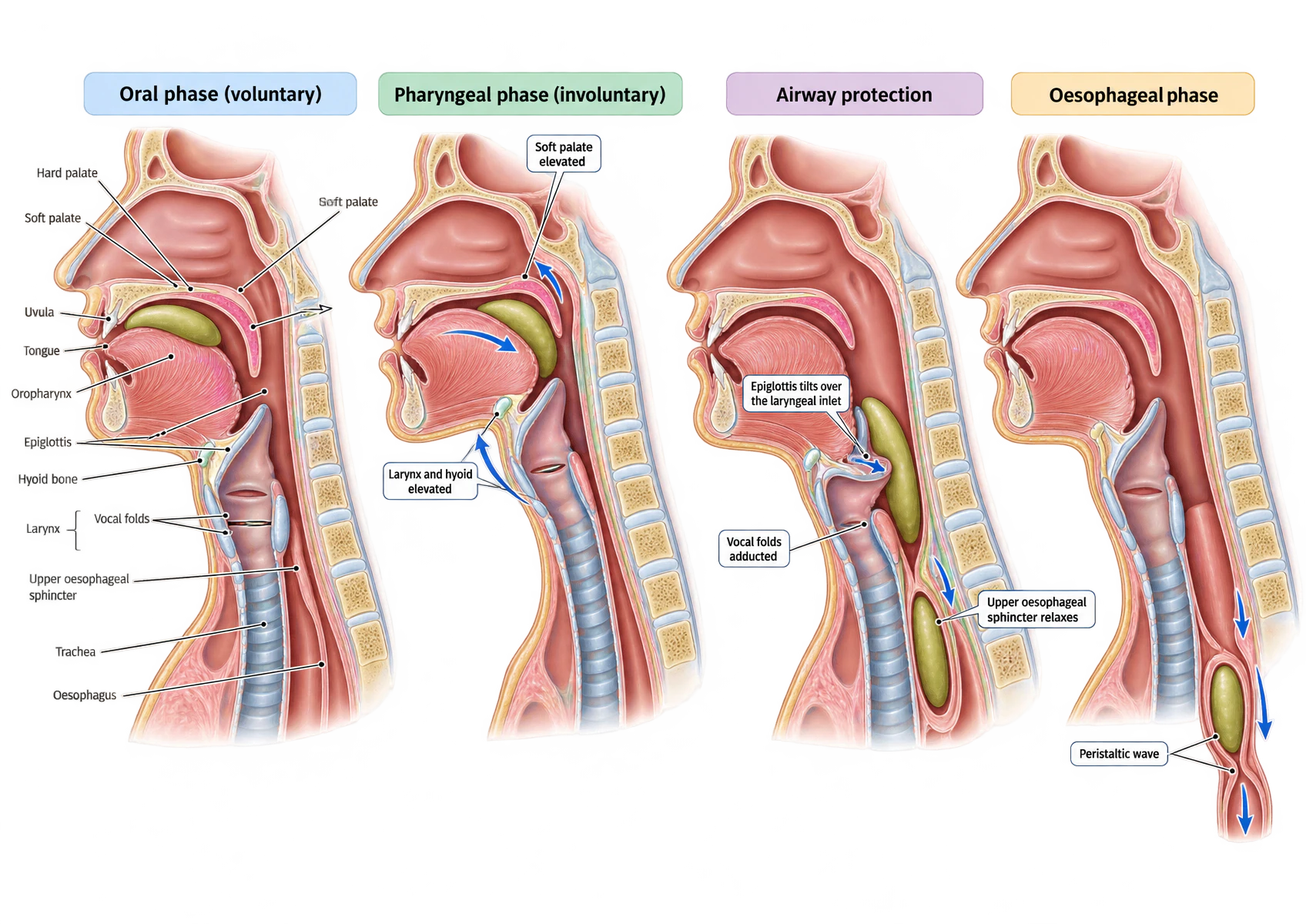 Four mid-sagittal panels of the head and neck through a swallow. The first shows the bolus in the oral cavity with the hard palate, soft palate, uvula, tongue, oropharynx, epiglottis, hyoid, larynx, vocal folds, upper oesophageal sphincter, trachea and oesophagus labelled. The second shows the soft palate elevated against the nasopharynx and the larynx and hyoid pulled upwards. The third shows the epiglottis tilted over the laryngeal inlet with the vocal folds adducted and the upper oesophageal sphincter relaxing. The fourth shows the bolus descending the oesophagus ahead of a peristaltic wave.